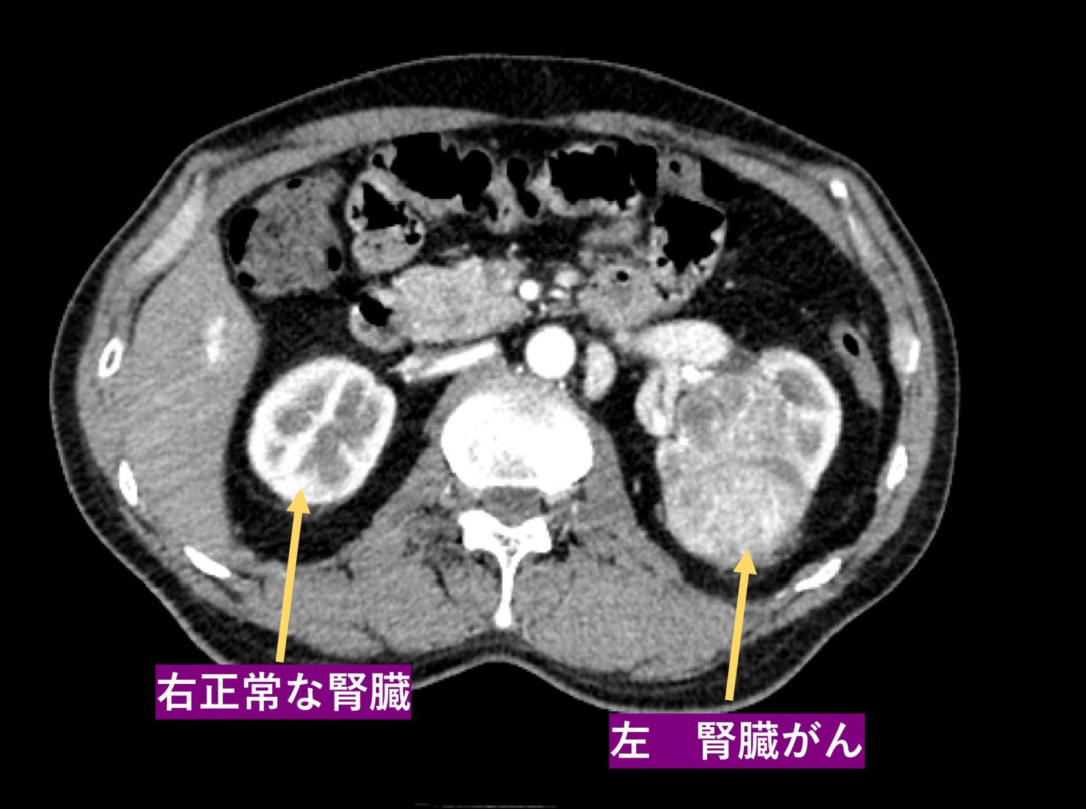 サポートを見つける場所
