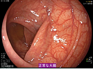 過敏性腸症候群の症状・原因・検査・治療について|東京都新橋駅徒歩1分の消化器科クリニック